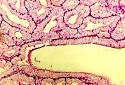 <b>Glándula Bulbouretral</b> (Cowper)