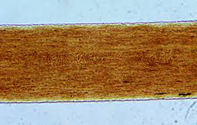 Image result for human hair microscope image