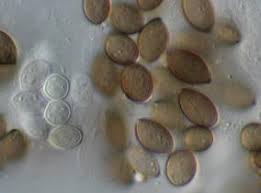 Attēlu rezultāti vaicājumam “Melanospora lagenaria”