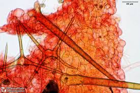 Attēlu rezultāti vaicājumam “Cheilymenia stercorea”