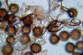 Attēlu rezultāti vaicājumam “Diderma spumarioides macro”