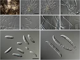 Attēlu rezultāti vaicājumam “Stemonitopsis aequalis var. microspora macro”