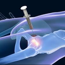 Image result for BMAC