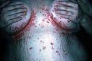 How To Treat Thrush