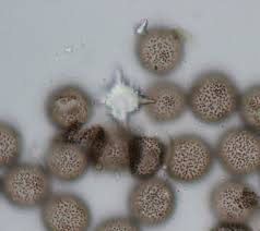 Attēlu rezultāti vaicājumam “Didymium melanospermum spores”