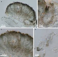 Attēlu rezultāti vaicājumam “Lichenoconium xanthoriae”