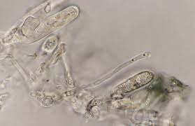 Attēlu rezultāti vaicājumam “Amaurochaete atra spores”