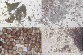 Attēlu rezultāti vaicājumam “Fuligo leviderma”