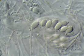 Attēlu rezultāti vaicājumam “Trapeliopsis granulosa”