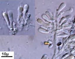 Attēlu rezultāti vaicājumam “Mucronella calva”