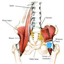 bursitis hip