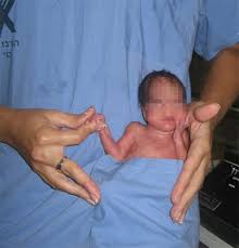 neonatal nurse