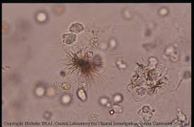 atlas of urinary sediment