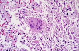lung tissue