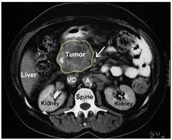 cross sectional anatomy