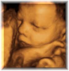 3d 4d ultrasound pictures