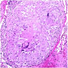 lung tissue