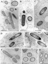 Listeria monocytogenes