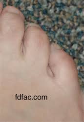 5 toed running shoes