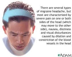 migraine symptoms