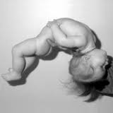 Prader-Willi Syndrome Symptoms