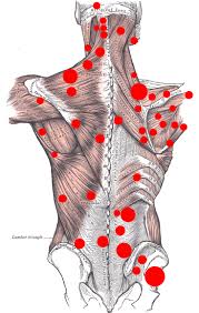 trigger point charts