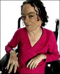  - _45212852_liz_carr226