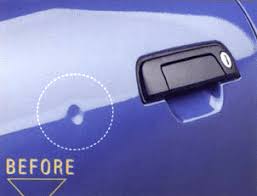 car dent