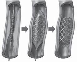 polymeric biomaterials
