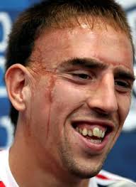 de Franck Ribéry (+18 ans