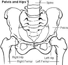 perthes disease