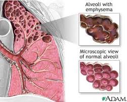 lung tissue