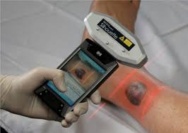 mobile scanner