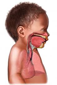 transient tachypnea of the newborn