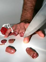 finger cut