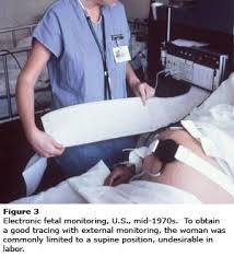 electronic fetal monitor
