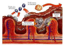 cleansing bowel