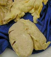 uterus cancer