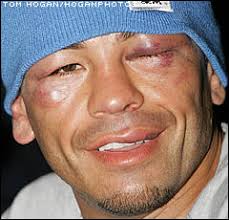 arturo gatti