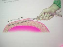 Con tratamientos estéticos también puedes mejorar tu sonrisa Image12244 Con tratamientos estéticos también puedes mejorar tu sonrisa