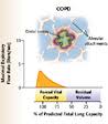 severe copd