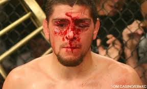 Got Up Next for Nick Diaz: