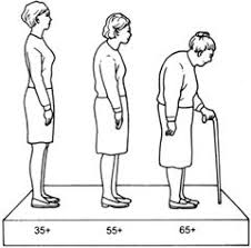 osteoporosis