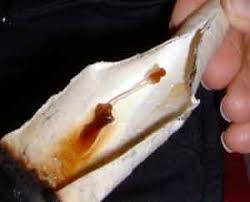 chinese ear candles