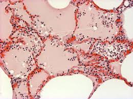 lung tissue
