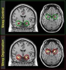 brain amygdala