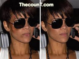 rihanna beat up pictures