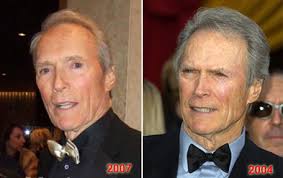 clint-eastwood-plastic-surgery.jpg