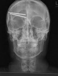 nail gun