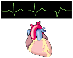 slow heartbeat